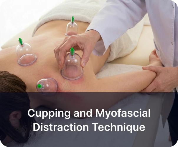 Cupping and Myofascial Distraction Technique